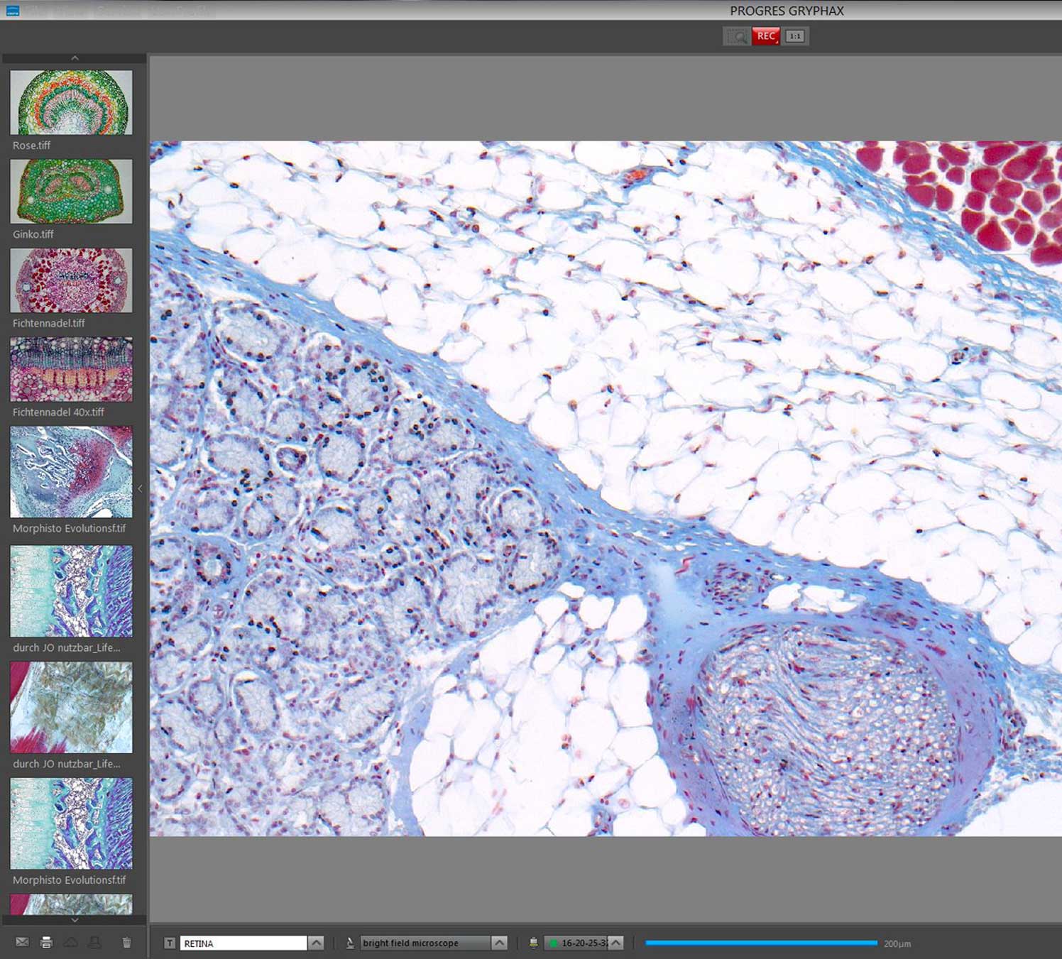 Bildaufnahme-Software PROGRES GRYPHAX®
