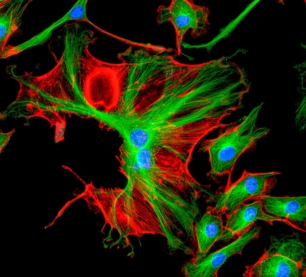 3 Kanal Fluoreszenzmikroskopie (rot, gruen, blau)