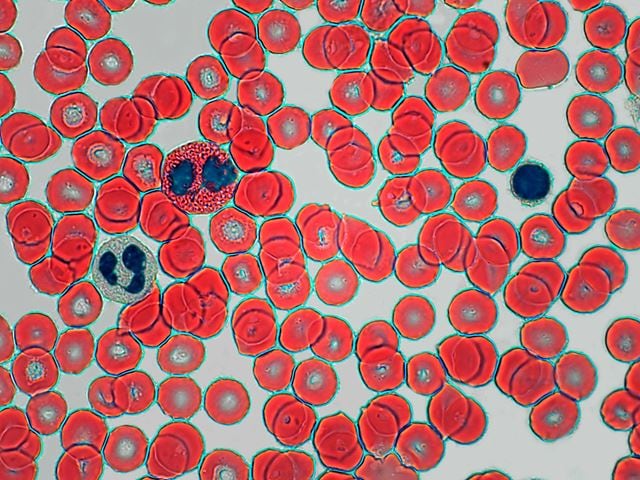 Haematoxylin-Eosin gefaerbte Blutkoerperchen