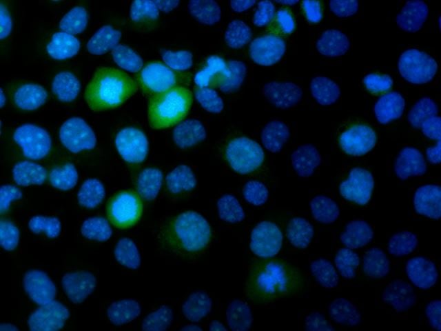 Menschliche Keratinozyten (HaCaT-Zellen) Maus Anti-Cenpf (alexa488)