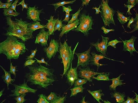 JENOPTIK SYIONS® Projektion - das perfekte Bild Multifluorescence