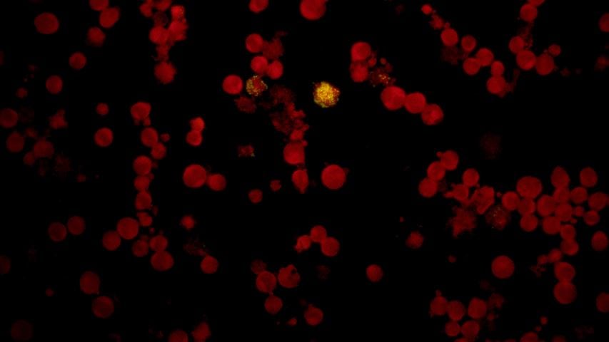GYPHAX-Bild einer hämatologischen Zellprobe