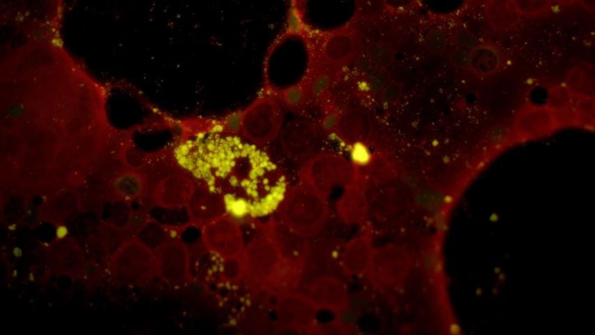 GYPHAX-Bild einer hämatologischen Zellprobe