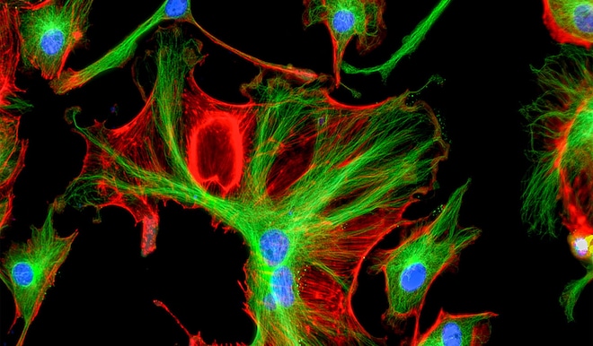 Mikroskopbild Fluoreszenz