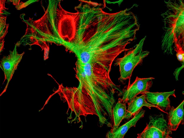 Mikroskopbild Fluoreszenz